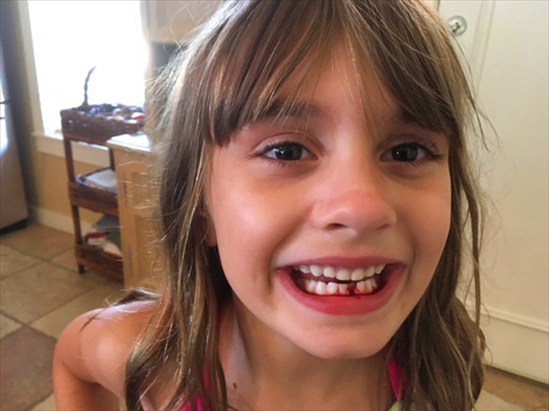 Addie after losing her first tooth
